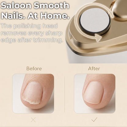 SafeTrim Nail Trimmer